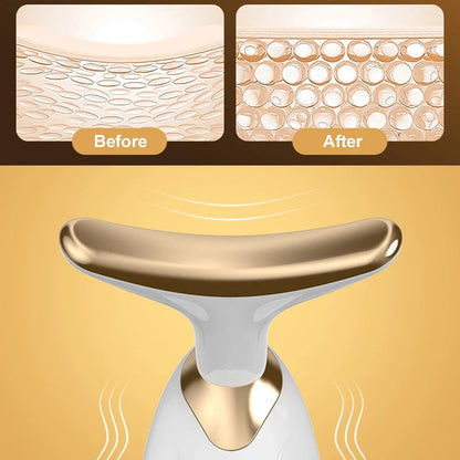 Elevador Facial Delfín LED
