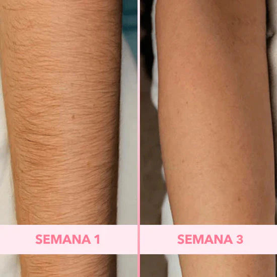 Depiladora Suave ImperiumGlow
