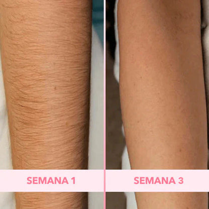 Depiladora Suave ImperiumGlow